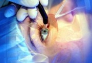 В Сочи смогут проводить уникальные глазные операции