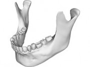 Краевые хирурги сделали пациентке новую челюсть, используя 3D-моделирование